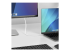 6.6 Ft. Usb C To Displayport Cable Adapter Dp To Usbc Convert - Närbild